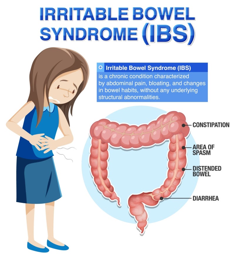 과민성 대장증후군 Irritable Bowel Syndrome IBS: “검사에는 이상이 없습니다.” 그런데 배는 매일 ....