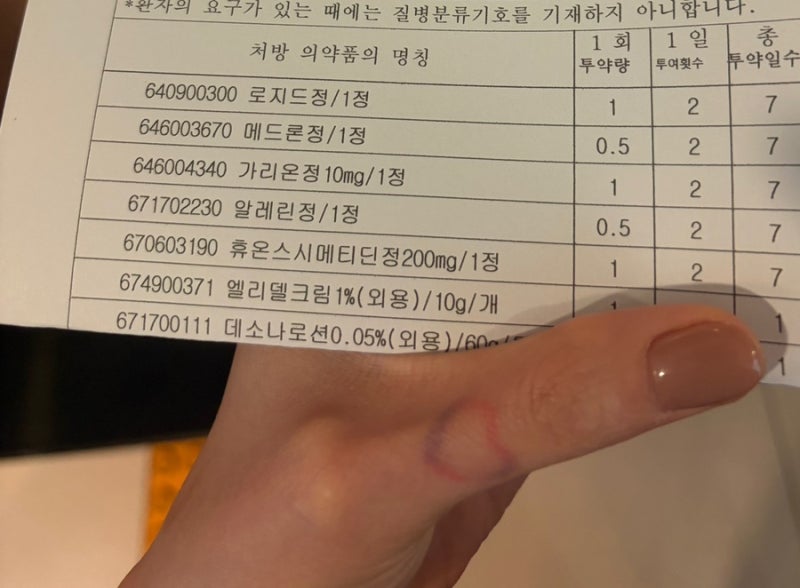 메드론정 부작용 식욕증가 여드름 모낭염 피부과 스테로이드 부작용 붓기