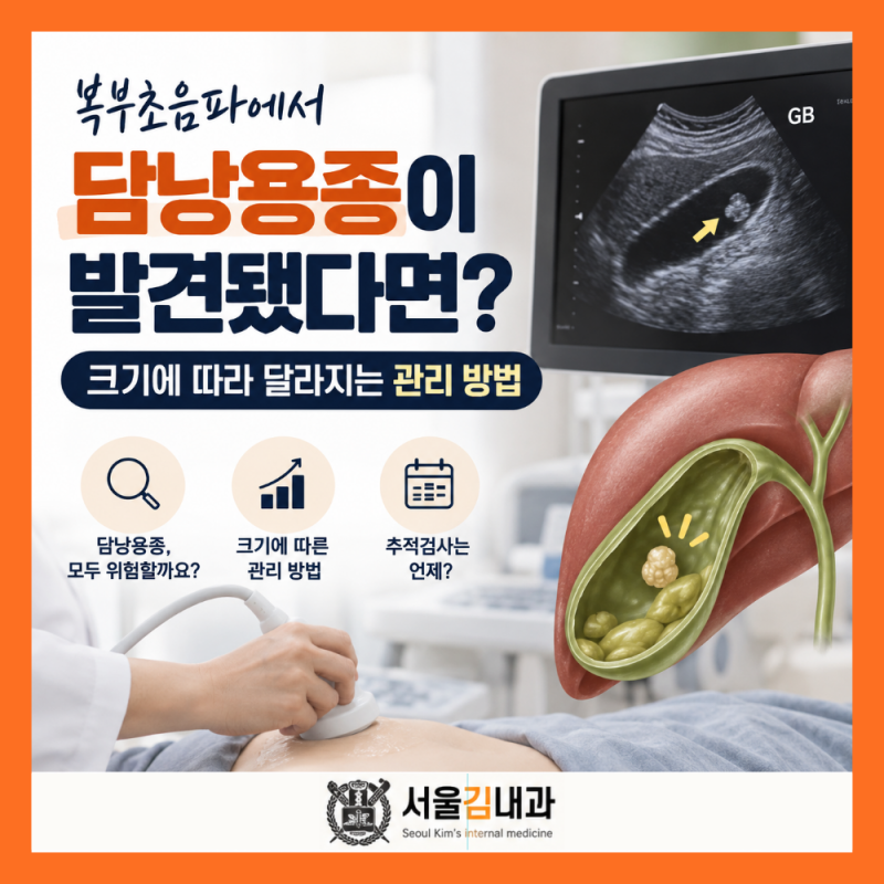 복부초음파에서 담낭용종이 발견됐다면? 크기에 따라 달라지는 관리 방법
