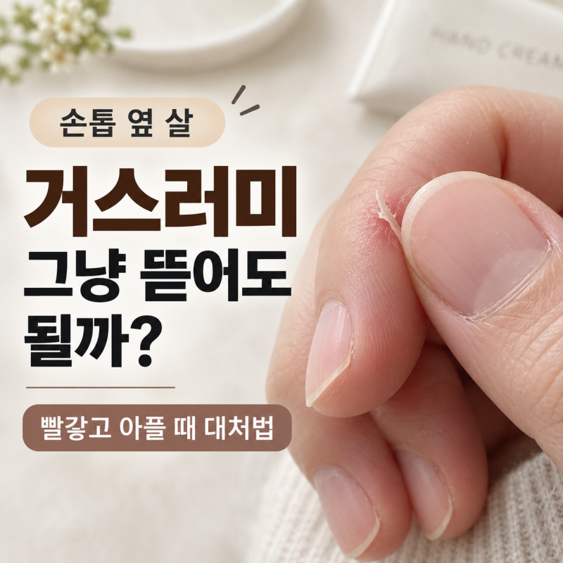 손톱 옆 거스러미 그냥 뜯어도 될까? 빨갛고 아플 때 대처법