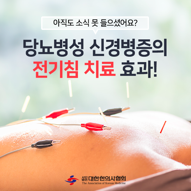 손발이 저리고 화끈거린다? 당뇨병성 말초 신경병증과 전침 치료 알아보기