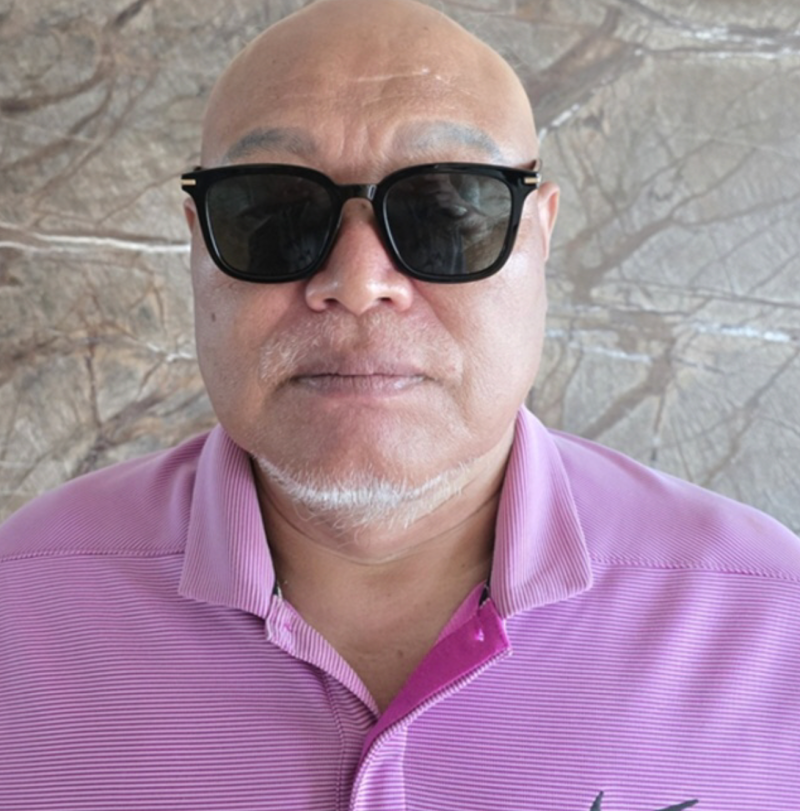 김흥국, 결국 민머리 공개한 이유? “머리 다 빠졌다” 탈모 치료제 모델 된 근황