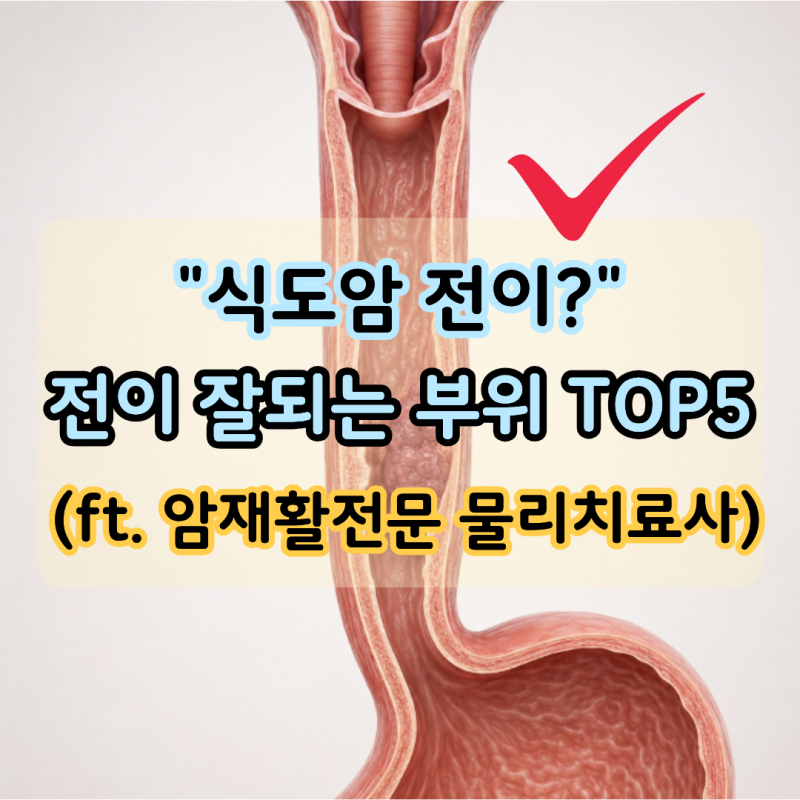 식도암 전이 잘되는 부위 TOP5, 가장 흔한 곳은?(ft. 암재활전문 물리치료사)
