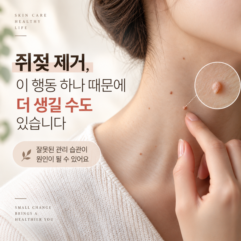 쥐젖 제거, 이 행동 하나 때문에 더 생길 수도 있습니다