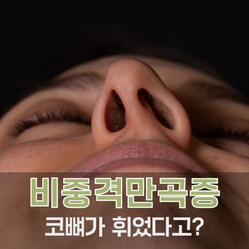 비중격만곡증 수술 전에 꼭 알아야 할 증상·비용·재발 가이드