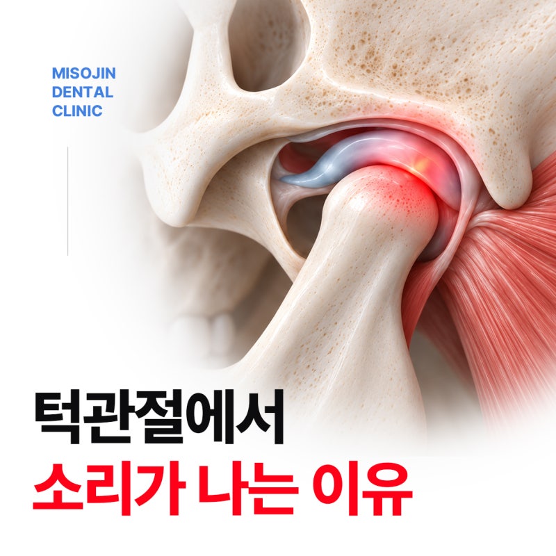 입벌릴 때 턱관절에서 딱딱 소리가 나는 이유 3가지