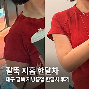 대구팔뚝지방흡입 한달차 코끼리팔뚝 탈출 후기 2탄