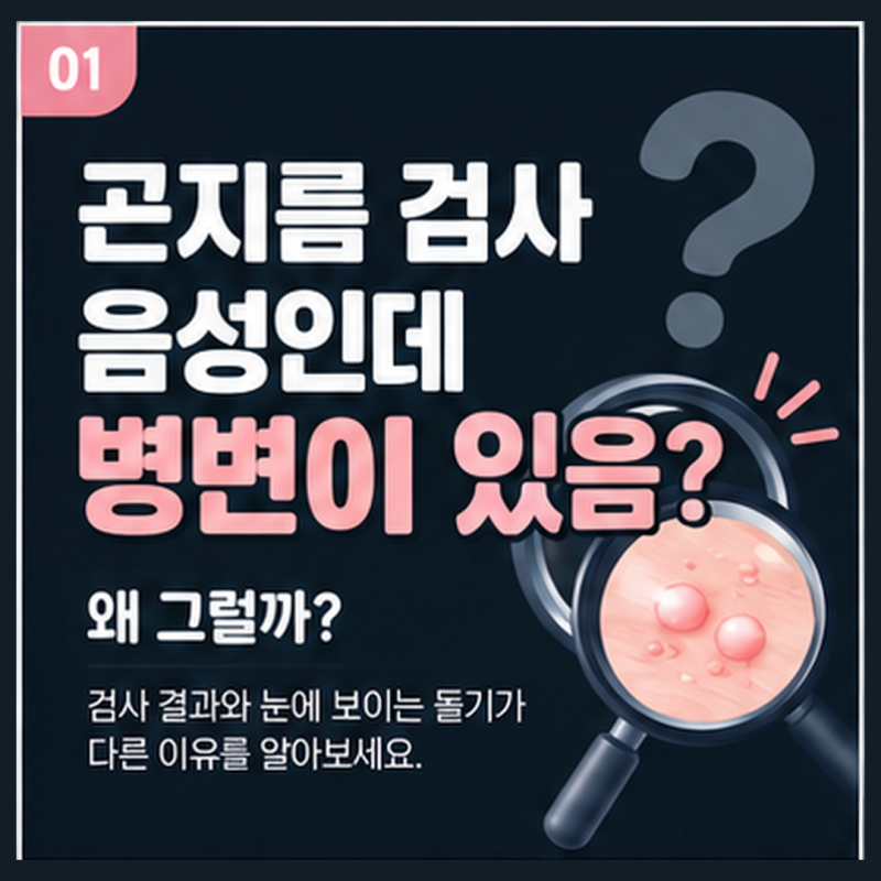 전남 광주 곤지름 검사 음성인데 병변 있음 왜 그럴까 검사 결과와 눈에 보이는 돌기가 다른 ....