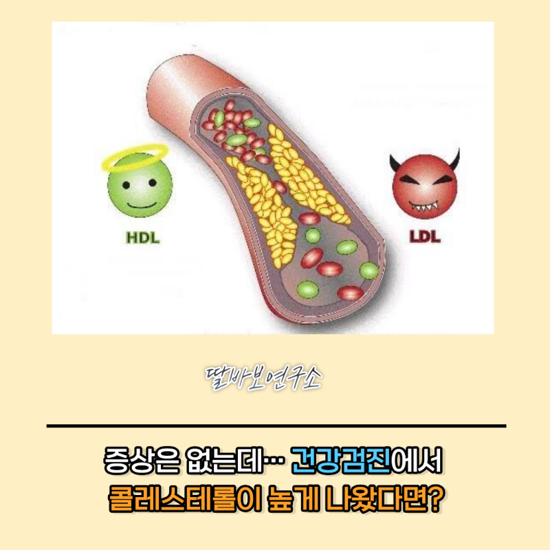 이상지질혈증, 증상 없는데 콜레스테롤이 높다면 꼭 알아야 할 것