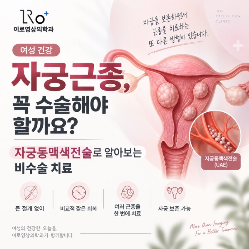 자궁근종 꼭 수술해야 할까요? 자궁동맥색전술로 알아보는 비수술 치료