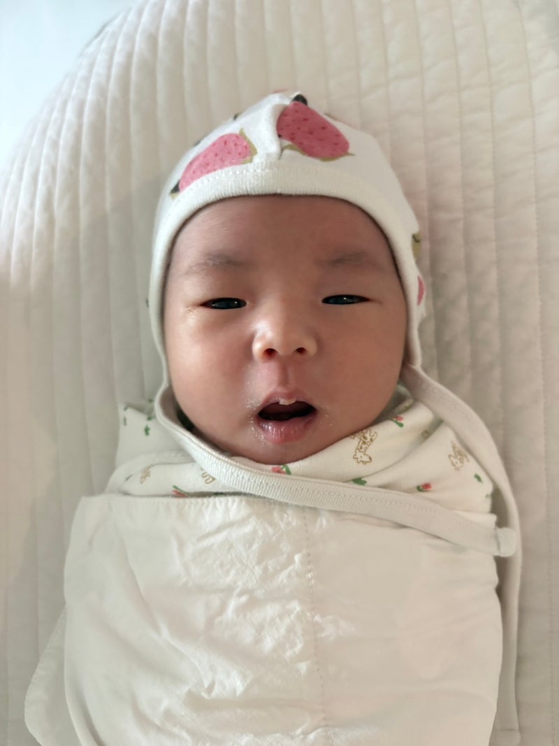 신생아 설소대 단설소대 시술 받아야할까? 비용 및 보험 청구 서류 후기