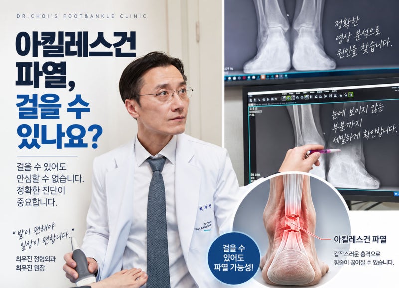아킬레스건파열 걸을 수 있나요? 걷기 가능해요 안심하면 안 되는 이유