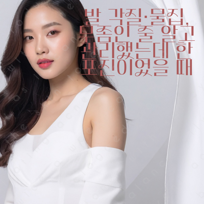 발 각질·물집, 무좀인 줄 알고 관리했는데 한포진이었을 때