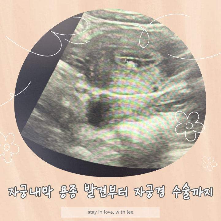 복부초음파를 통한 자궁내막 용종 발견부터 자궁내시경(자궁경) 수술까지; 용종 제거 수술이....