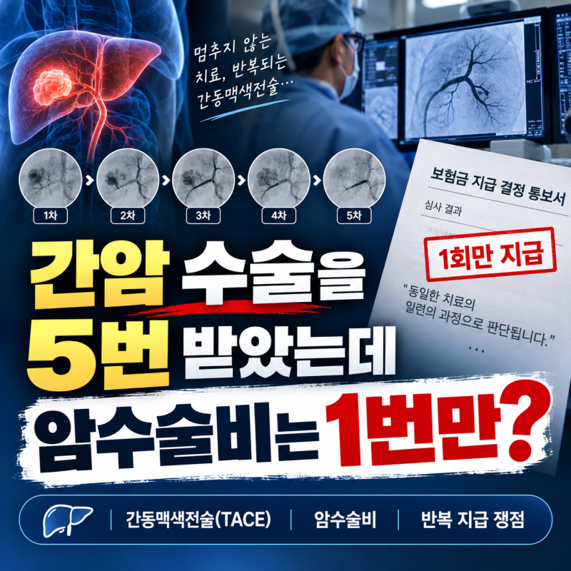 간동맥화학색전술(TACE) 암수술비 1회만? 거절된 5회분 전액 수령 성공 사례