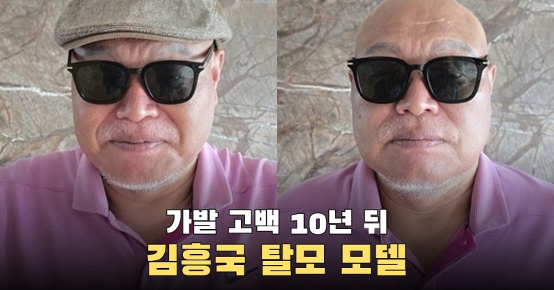 10년 전 가발 고백한 김흥국, 이번엔 탈모 치료제 광고 모델 됐다