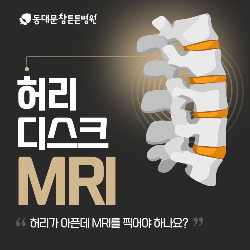 허리디스크 MRI 허리가 아프면 바로 찍어야 할까요?