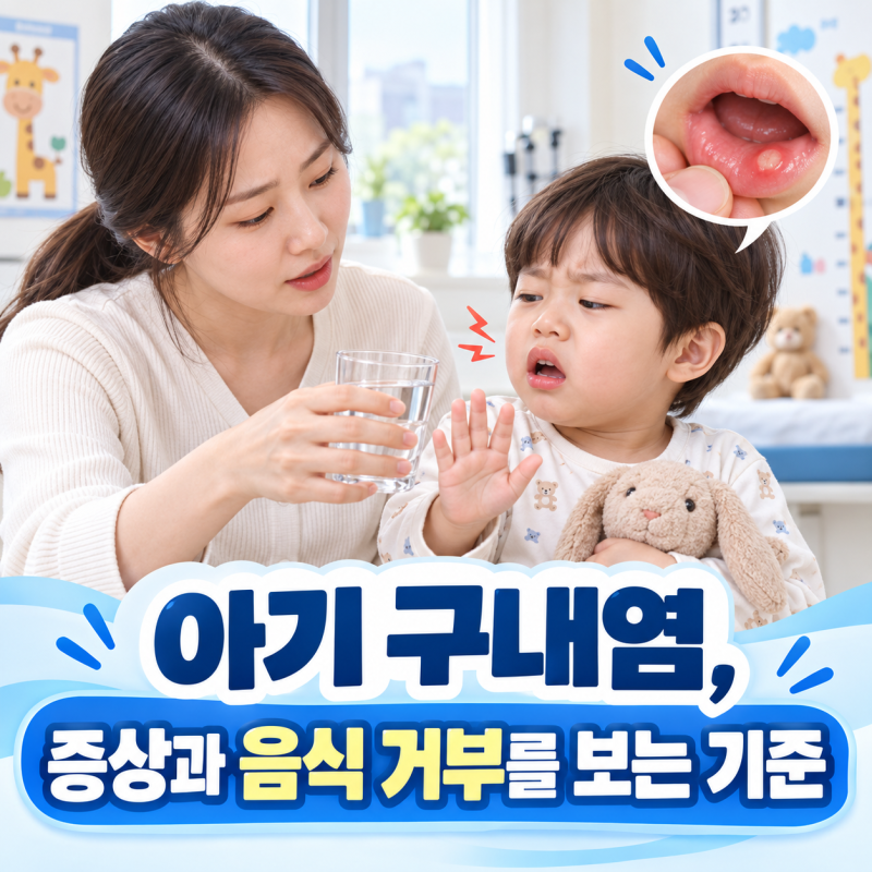 아기 구내염, 증상과 음식 거부를 보는 기준