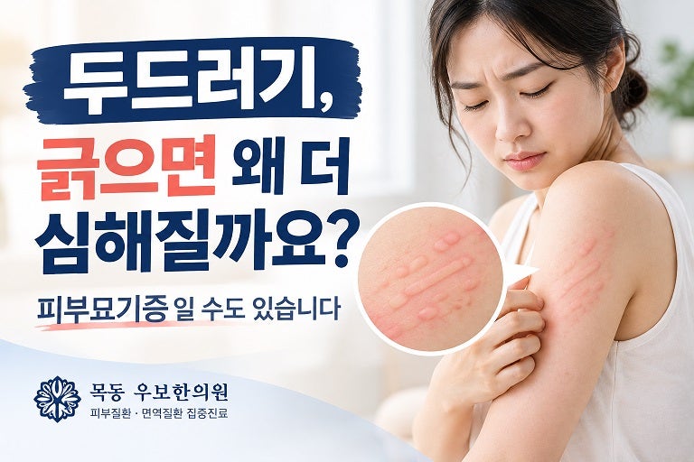 두드러기, 긁으면 왜 더 심해질까요? 피부묘기증일 수도 있습니다 (목동 우보한의원)
