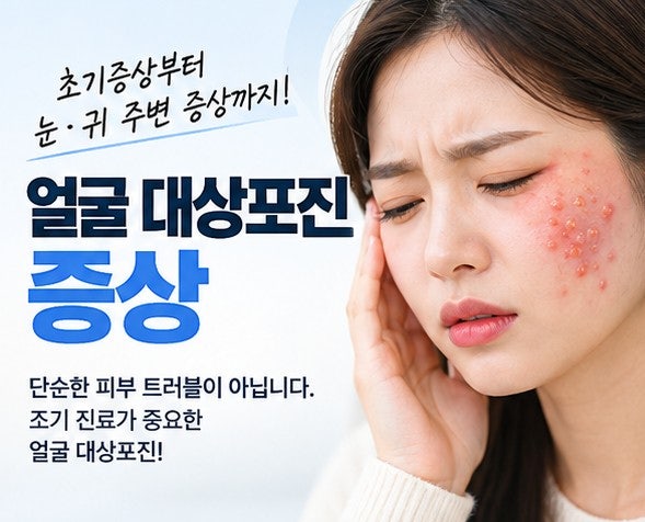 얼굴 대상포진 증상｜초기증상부터 눈·귀 주변 증상까지 총정리