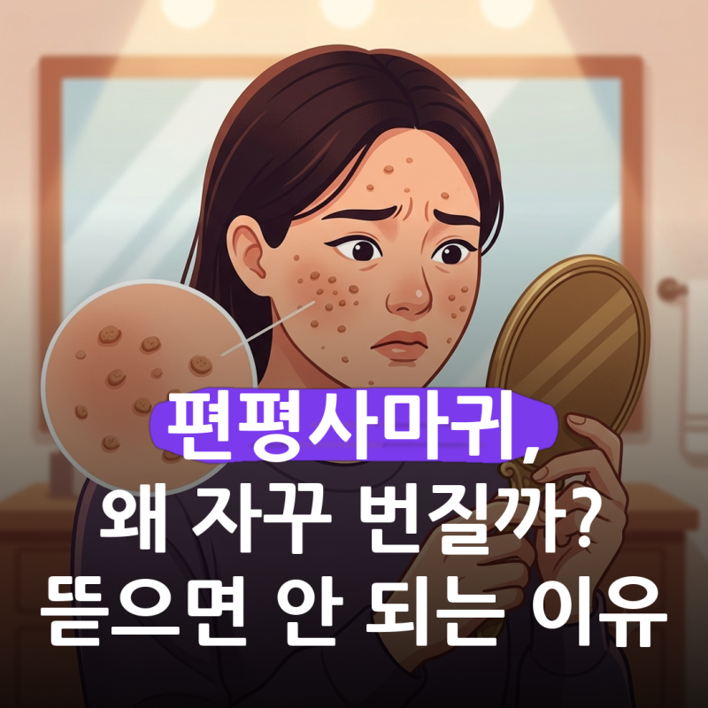 편평사마귀 원인과 티눈 차이, 얼굴에 번지는 이유와 치료는 어떻게