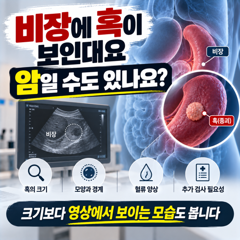 초음파에서 우연히 발견된 비장 혹, 바로 제거할까