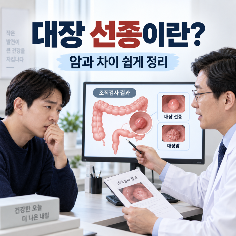 대장 용종 조직검사 결과 선종이란? 암과 어떤 차이가 있을까