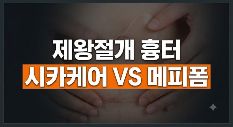 제왕절개 실밥 제거 후 흉터착색관리: 시카케어 VS 메피폼 차이점 총정리 (밀착력, 세척 재사....