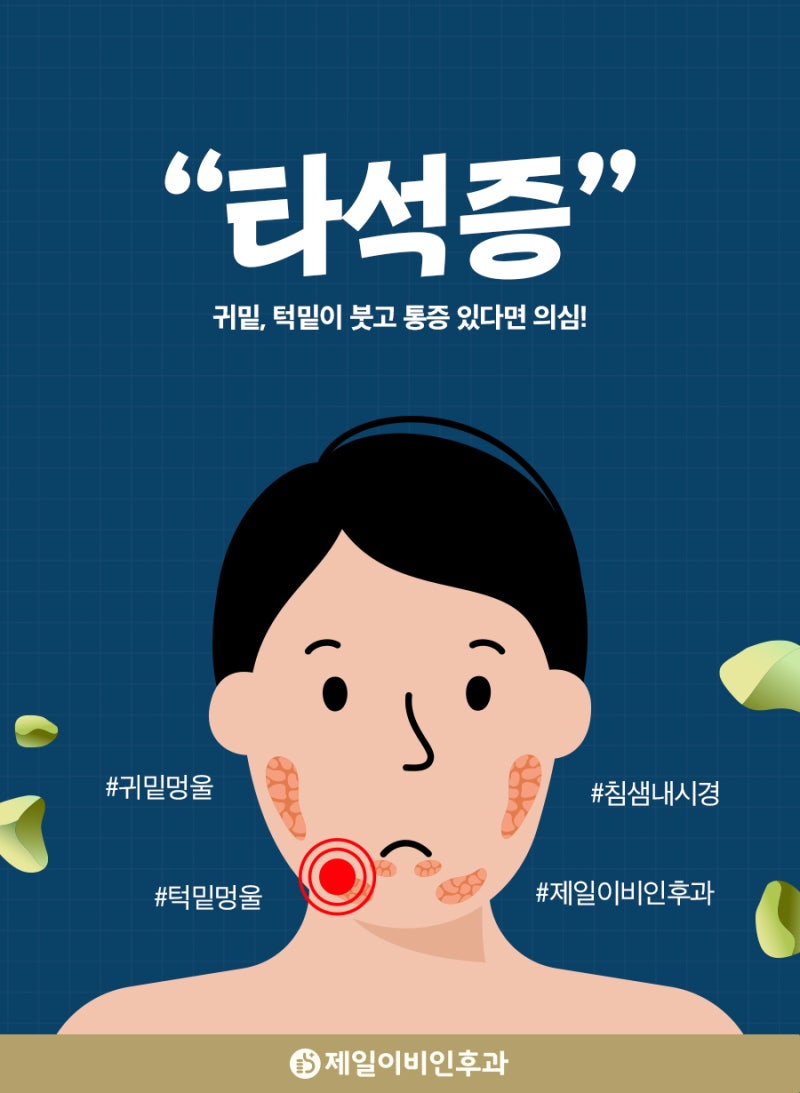 밥 먹을 때 턱밑이 붓고 아픈 타석증 수술해야 할까요?