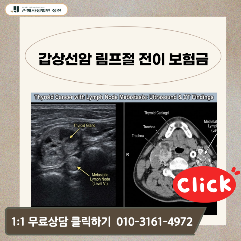 갑상선암 림프절 전이 보험금, C73·C77 진단에도 소액암 삭감 통보가 과연 정당할까?