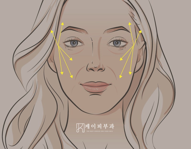 부산 고우리스킨부스터 효과 통증 부작용 유지기간 총정리