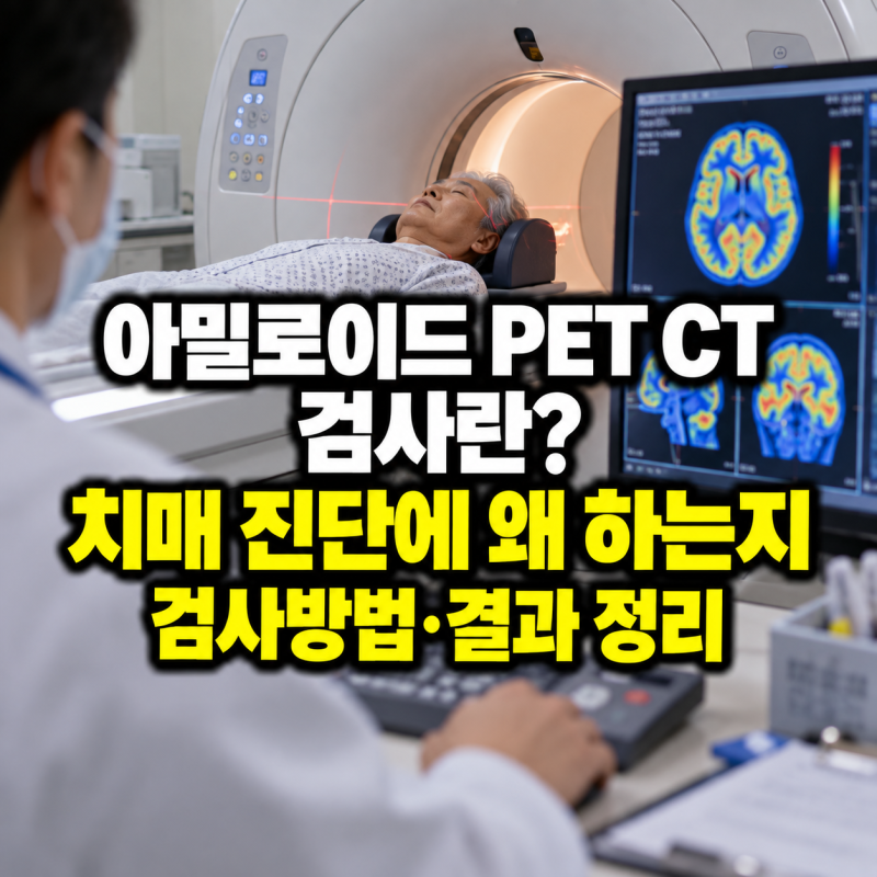 아밀로이드 PET CT 검사란? 치매 진단에 왜 하는지 검사방법 결과 정리