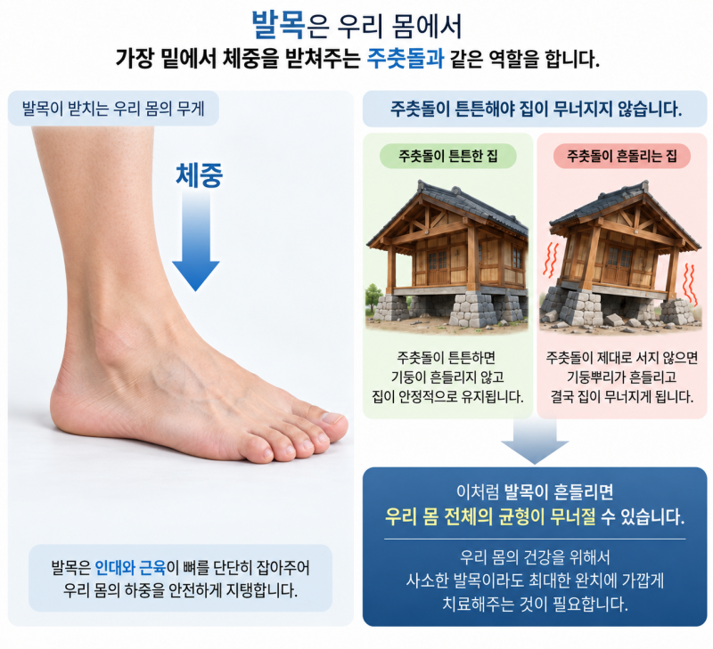 발목을 삐끗했는데 언제까지 치료해야되요?
