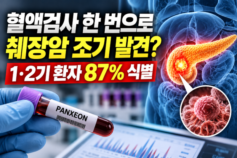 혈액검사 한 번으로 췌장암 조기 발견? 1·2기 환자 87% 찾아냈다