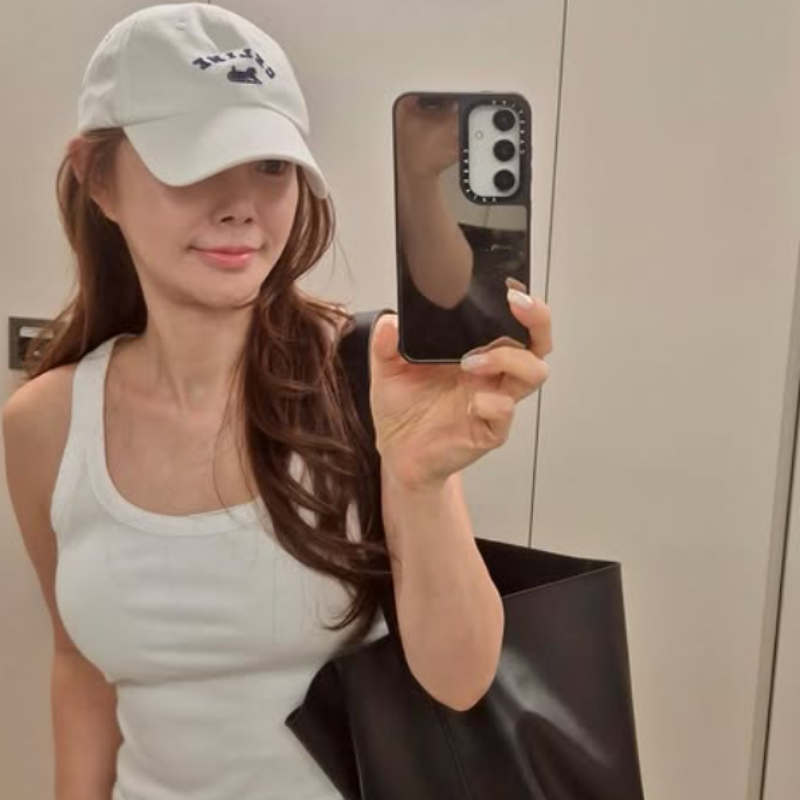 “엄마 얼굴조차 못 알아봤다” 30대 뇌출혈 이겨낸 트로트 여신의 건강관리법