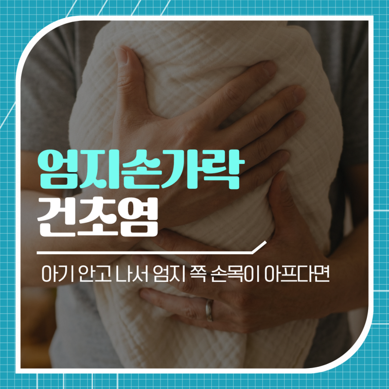 엄지손가락 건초염, 아기 안고 나서 엄지 쪽 손목이 아프다면?
