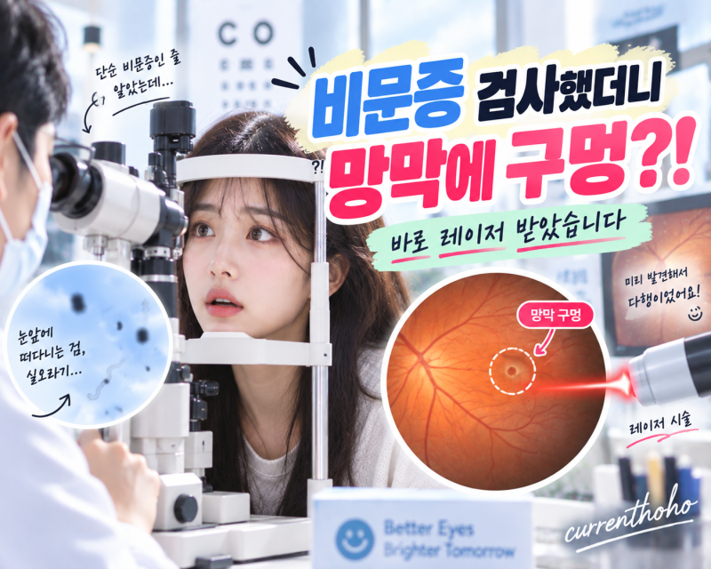 비문증 때문에 산동검사 받았다가 망막 구멍 발견! 바로 망막 레이저 광응고술 받은 후기!