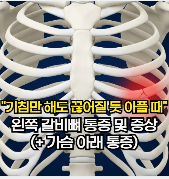 왼쪽 갈비뼈 통증, "기침만 해도 끊어질 듯 아플 때 확인해야 할" 왼쪽 가슴 아래 통증 및 증....
