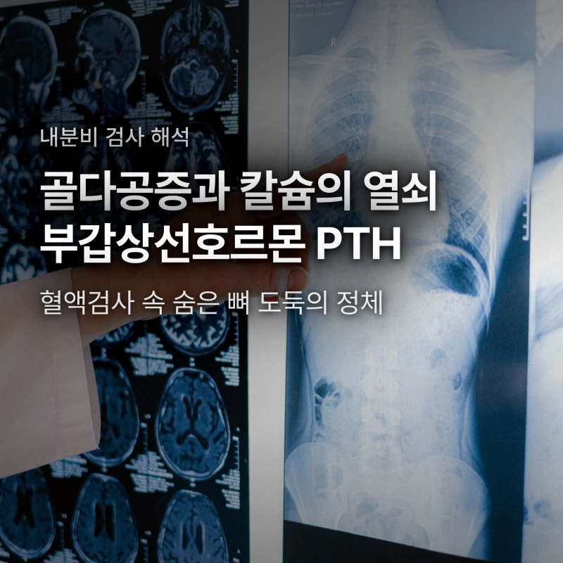 칼슘 수치 정상인데 골다공증 진단? 부갑상선호르몬 PTH가 범인인 이유