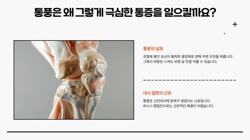 바람만 불어도 아픈 통풍 뜻, 단순한 관절 통증과 다른 이유는?