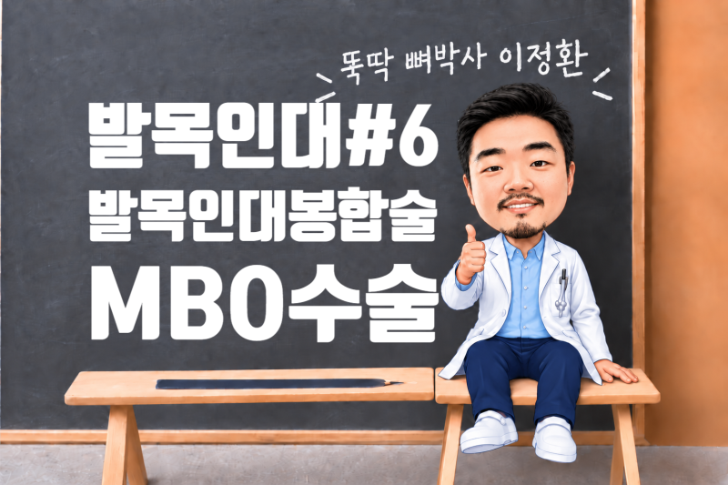 발목인대#6. 늘어난 발목인대는 어떻게 수술할까요? – MBO 수술