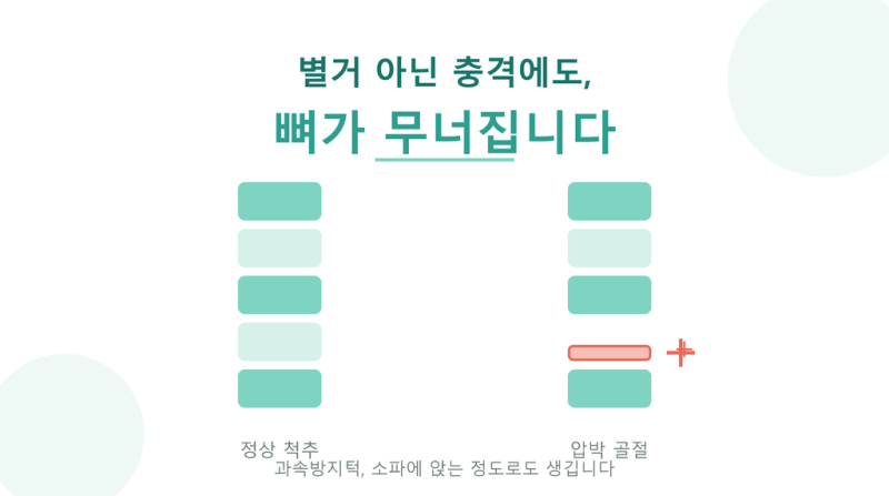 척추압박골절 증상과 원인, 별거 아닌 충격에도 뼈가 무너집니다 (몸신의 탄생 102회)