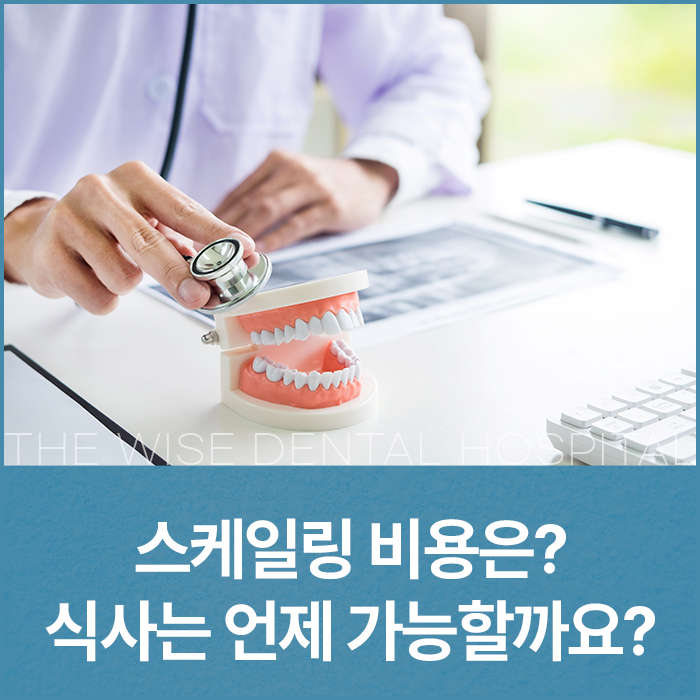 스케일링 비용 얼마일까요? 스케일링 후 식사는 언제 가능할까?