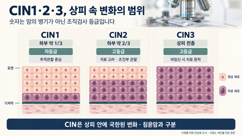 자궁경부 이형성증 단계별 치료가 다른 이유