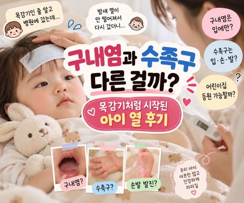 구내염, 수족구, 목감기 어떻게 다른 걸까? 목감기처럼 시작된 아이 수족구 후기