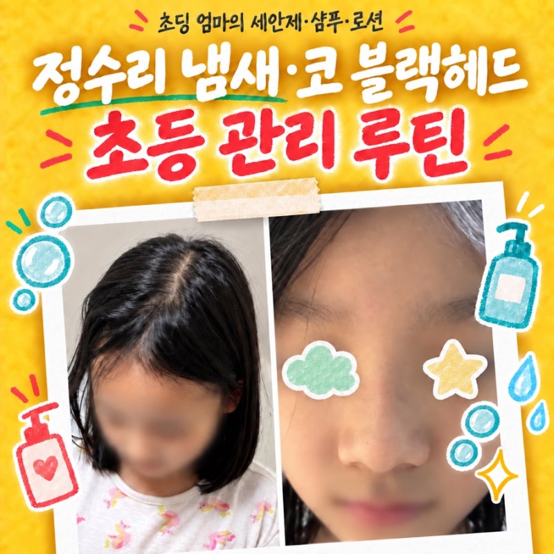 [실관리비법]✅ 초등학생 정수리 냄새·코 블랙헤드가 신경 쓰이기 시작했다면｜초딩 엄마 ....