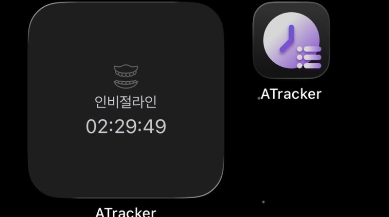 인비절라인 후기 / 인비절라인 모더레이트, 기간, 교정 전 사진, 시간 관리법 (ATracker)