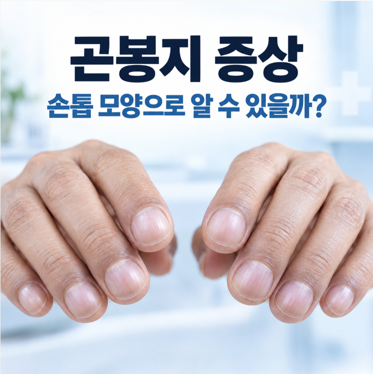 곤봉지 증상 손톱 모양으로 알 수 있을까? 원인과 폐암 연관성