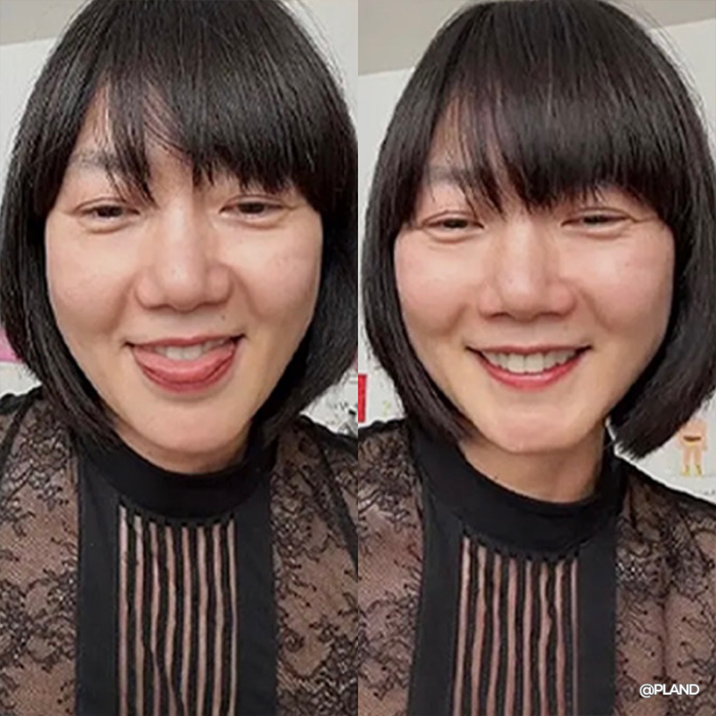 46세 배두나... 얼굴 '확' 달라 보인다는 말 나온 이유