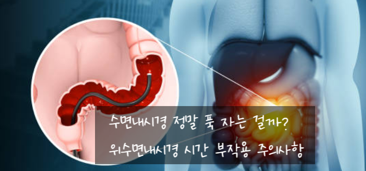 수면내시경 정말 푹 자는 걸까? 위수면내시경 시간 부작용 주의사항